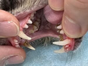 歯石除去前の状態
